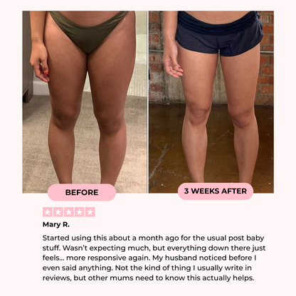 OSTERA Thigh & Pelvic Trainer